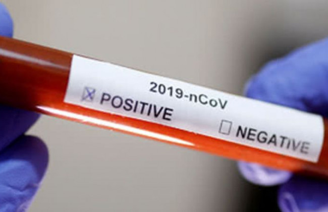 Коронавирус в ВСУ: заразилось почти два десятка военнослужащих