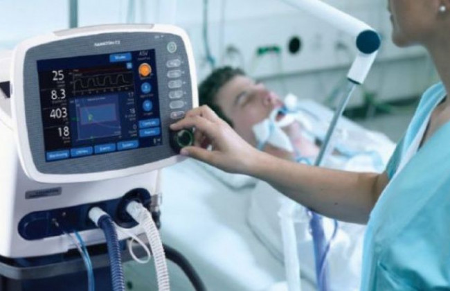 Коронавірус: яка область найбільше закупила апаратів ШВЛ