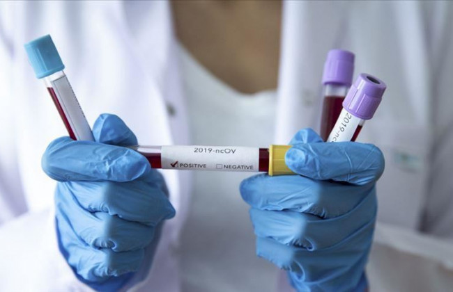 В Києві зросла кількість хворих на COVID-19