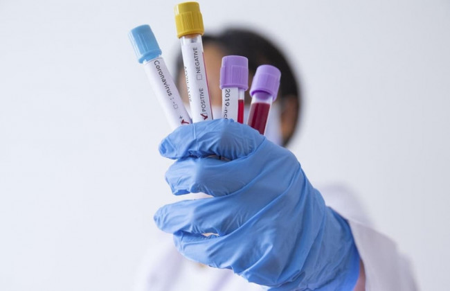 В Украине возросло количество медиков, зараженных коронавирусом