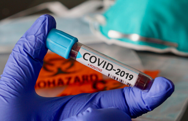 В Україні різко зросла кількість хворих на COVID-19