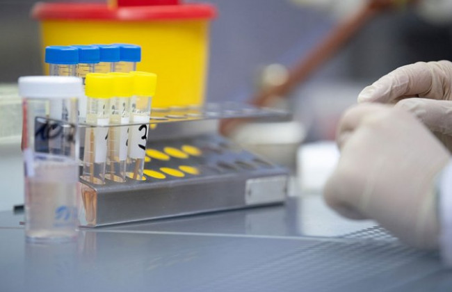 Кількість нових випадків зараження коронавірусом у Києві знову зросла: подробиці