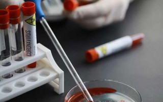 Страхові виплати медикам, що борються з коронавірусом: прийнято закон