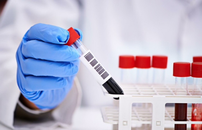 Под Киевом зафиксировали вспышку COVID-19 в нелегальном доме престарелых:  трое людей умерли