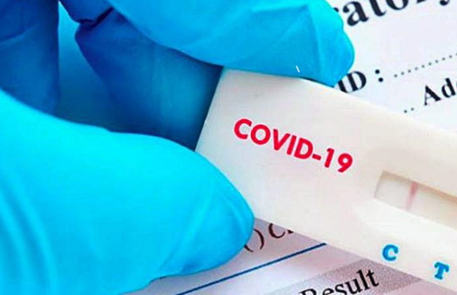 Платное тестирование на COVID-19: в Минздраве сообщили, кто должен будет заплатить сам