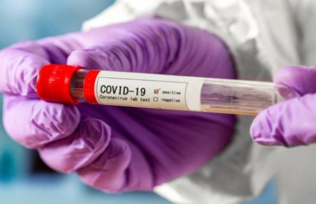 Кабмин внес коронавирус в перечень профессиональных заболеваний