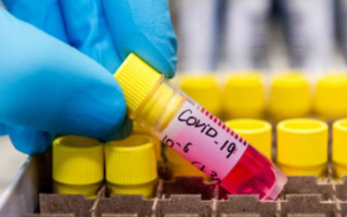 Понад 400 нових випадків: оновили дані щодо інфікованих коронавірусом