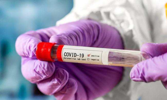 Внесення COVID-19 до списку небезпечних інфекційних хвороб: суд відкрив провадження у справі