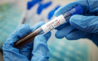 В Украине продолжает расти количество больных с COVID-19