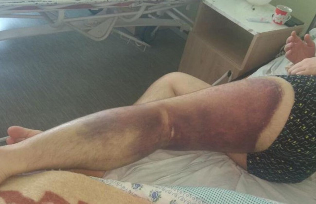 Жорстоко побили оператора майнінг-ферми: миколаївські копи постануть перед судом