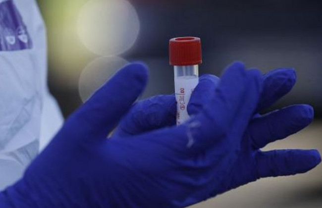 Коронавірус в Україні: почалося тестування методом імуноферментного аналізу