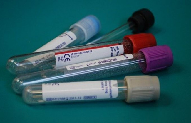 Назвали райони Києва з найбільшою кількістю заражених COVID-19: карта на 1 червня