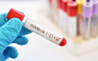 Скорочення приросту COVID-19 в Україні: за добу менше 400 нових випадків