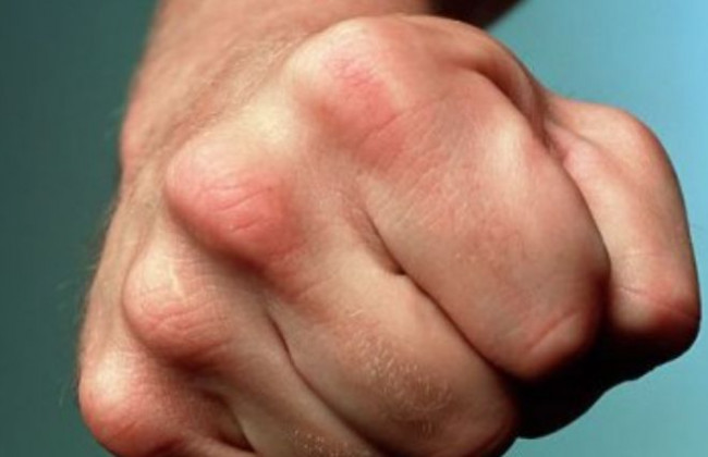 В Сумах мужчина напал на полицейского: что известно