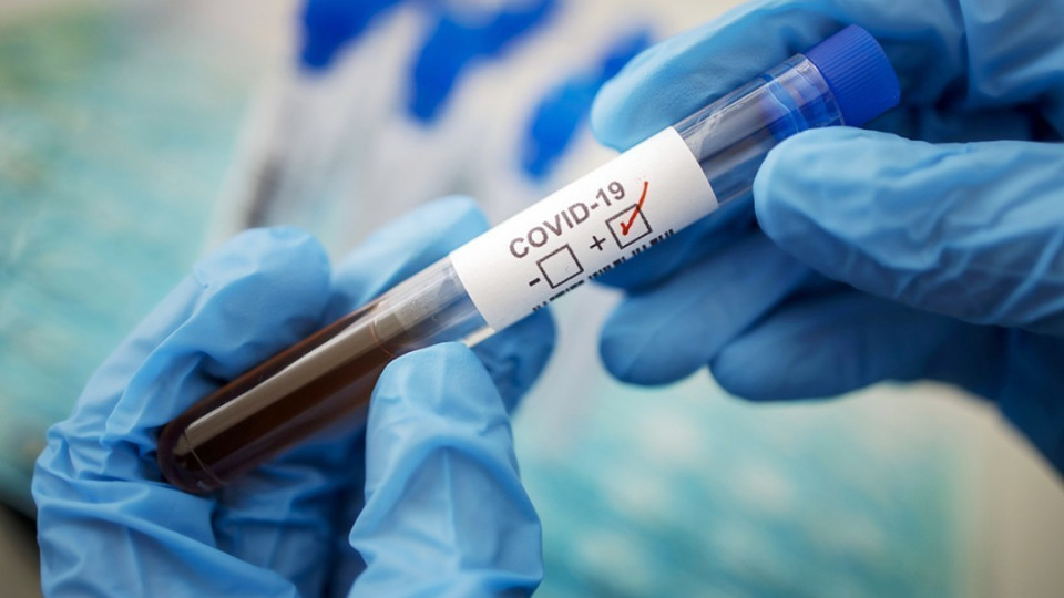 Ріст захворювання: в Україні за добу зафіксовано понад 500 нових випадків коронавірусу