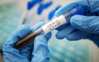 Ріст захворювання: в Україні за добу зафіксовано понад 500 нових випадків коронавірусу