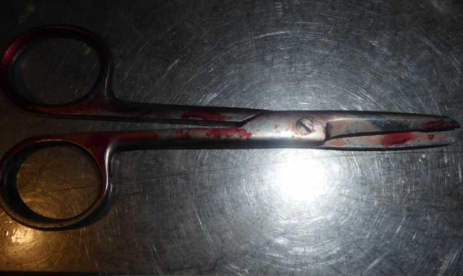 Ножницами в шею: на Гидропарке произошла кровавая потасовка