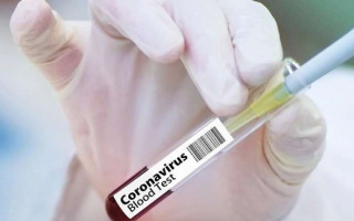 Почти 700 случаев за сутки: в Украине новый антирекорд по коронавирусу