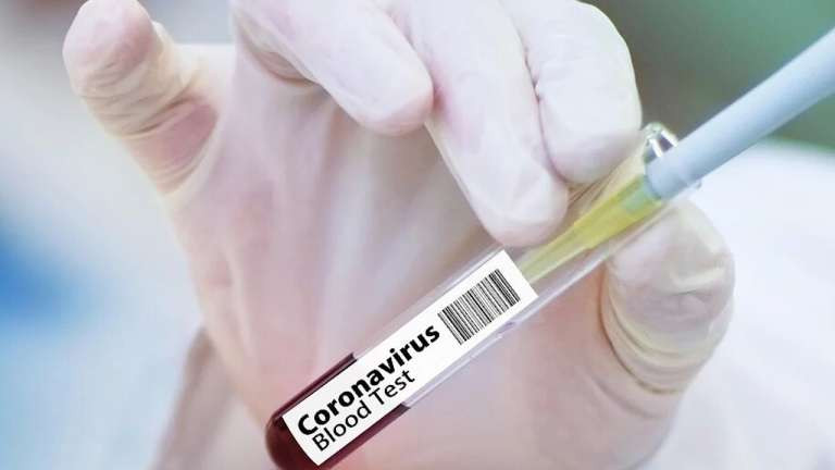 Почти 700 случаев за сутки: в Украине новый антирекорд по коронавирусу