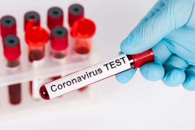 Почему резко увеличилось количество случаев коронавируса: Ляшко дал ответ