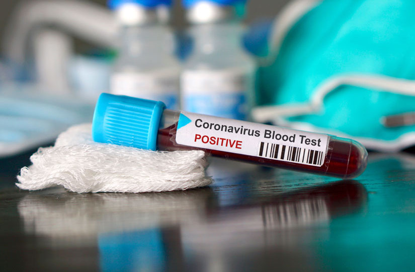 Нова хвиля коронавірусу: у Кабміні повідомили невтішний прогноз