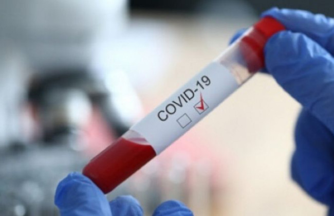 Спахал COVID-19 у Міжрегіональному управлінні Мін’юста: що відомо