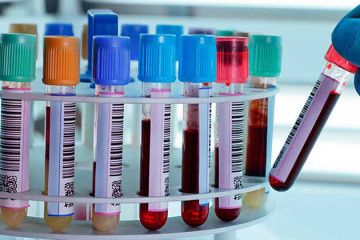 Обов’язкове тестування: працівників торговельних мереж перевірятимуть на коронавірус