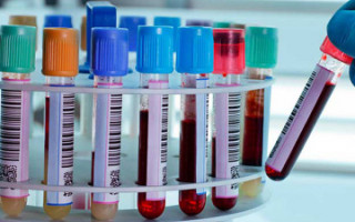 Обов’язкове тестування: працівників торговельних мереж перевірятимуть на коронавірус