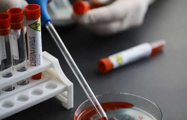 Почалися виплати сім'ям медиків, які померли в боротьбі з коронавірусом