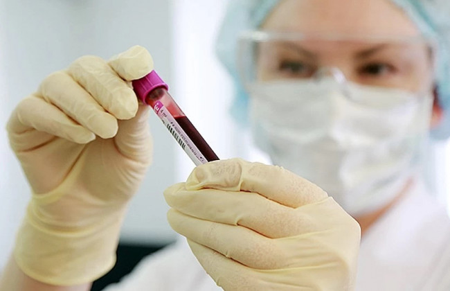 В Украине количество зараженных коронавирусом увеличилось на 706 человек