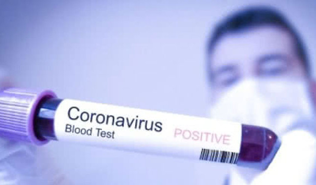 У 57 киян виявили COVID-19, найбільше випадків – у Дніпровському районі