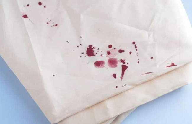 У Запоріжжі бійка в кафе закінчилася різаниною: що відомо