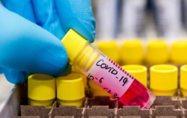 Понад 800 нових випадків: у МОЗ повідомили кількість інфікованих на COVID-19