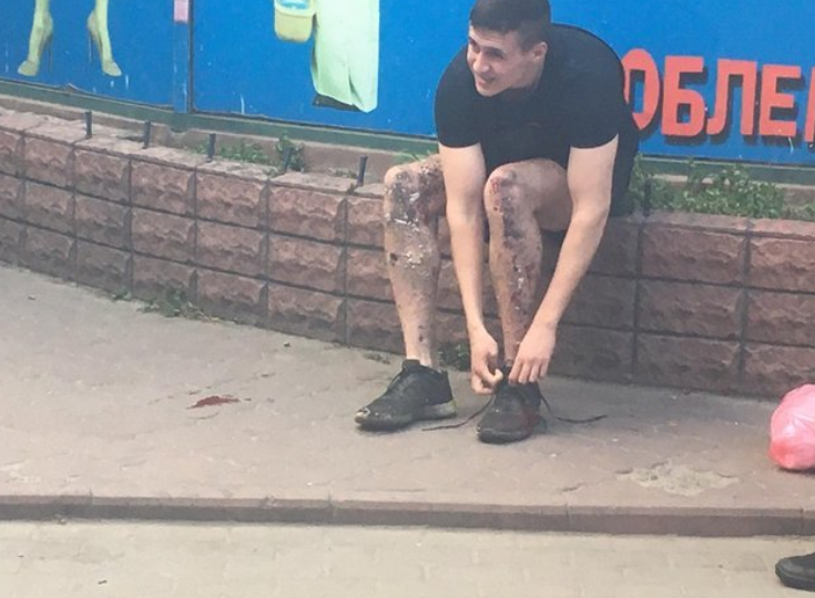 Стало известно, кто устроил взрыв возле киевского метро, где пострадал студент
