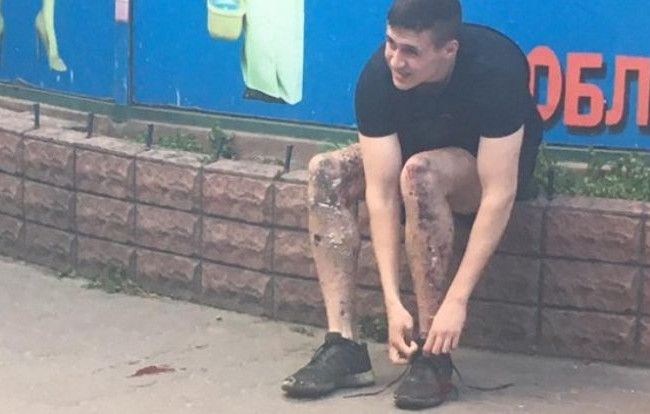 Взрыв возле станции метро Шулявская: медики прооперировали студента