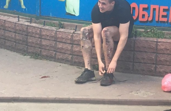 Стало известно, кто устроил взрыв возле киевского метро, где пострадал студент