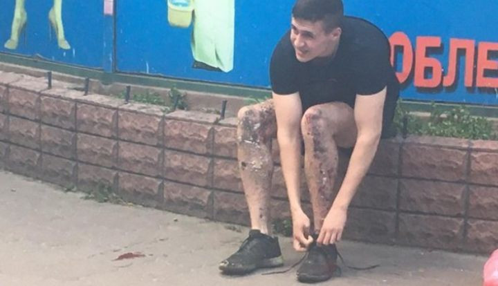Взрыв возле станции метро Шулявская: медики прооперировали студента