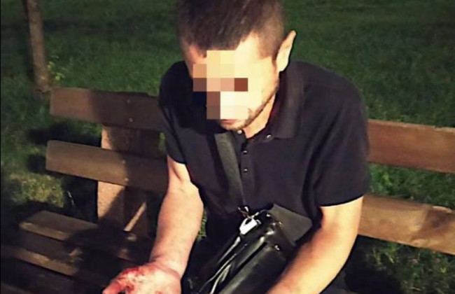 В киевском парке нашли парня без сознания