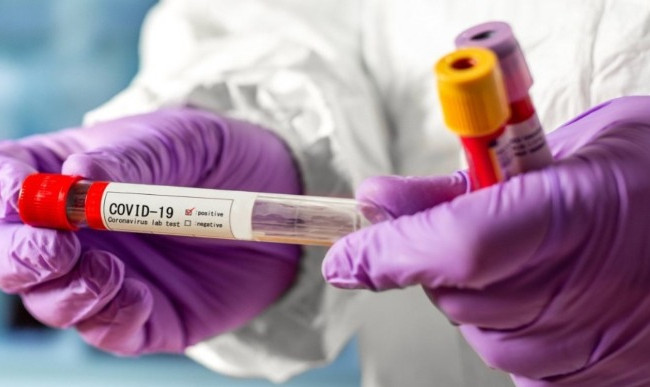 Майже 90 киян захворіли на коронавірус минулої доби