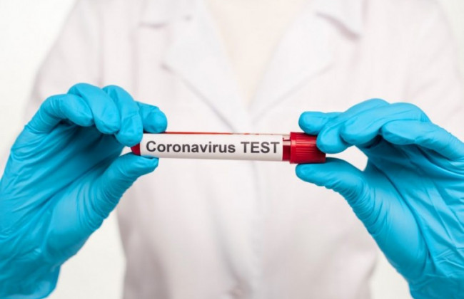 Одна з країн ЄС безкоштовно тестуватиме прибулих українців на  COVID-19