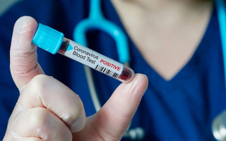 У Центральній виборчій комісії виявили Covid-19