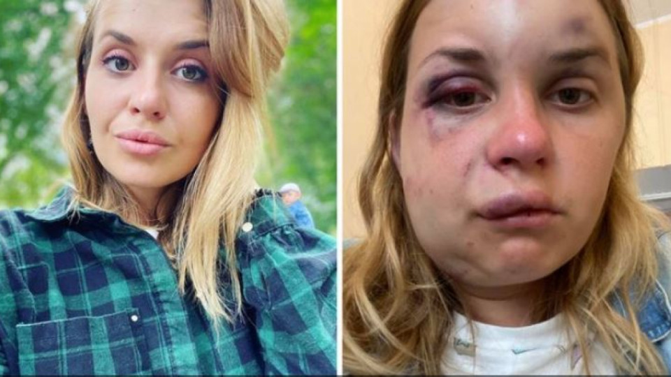 Избитая девушка в поезде Мариуполь—Киев рассказала о своем самочувствии