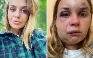 Избитая девушка в поезде Мариуполь—Киев рассказала о своем самочувствии