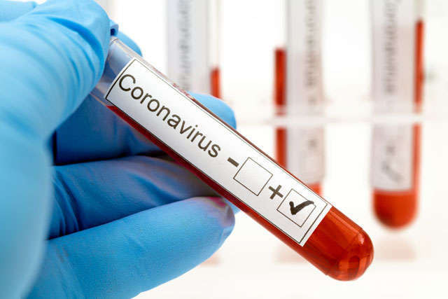В Украине почти 1500 новых случаев коронавируса за сутки
