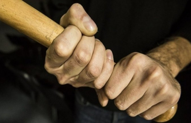 «Теплий прийом»: на Житомирщині чоловік смертельно травмував гостя