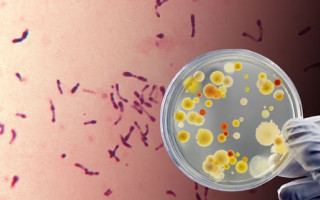 У Херсонській області зафіксовано спалах небезпечної хвороби