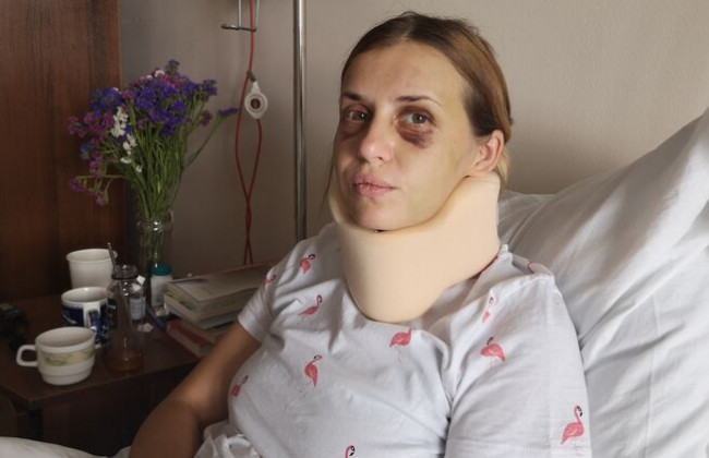 Избитая в поезде Анастасия Луговая рассказала, как ей предлагали «замять скандал»