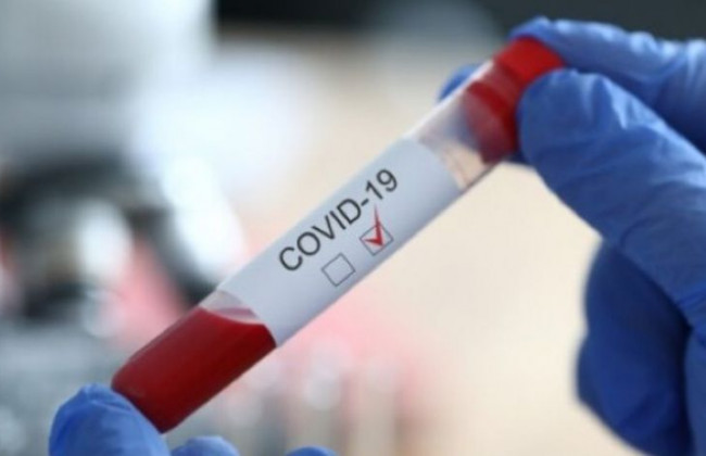 Под Киевом в роддоме произошла вспышка коронавируса