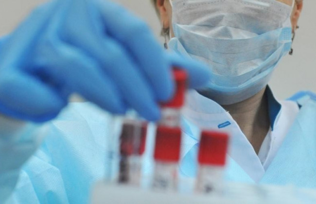 Кількість інфікованих COVID-19 в Україні наближається до 4 000, – МОЗ