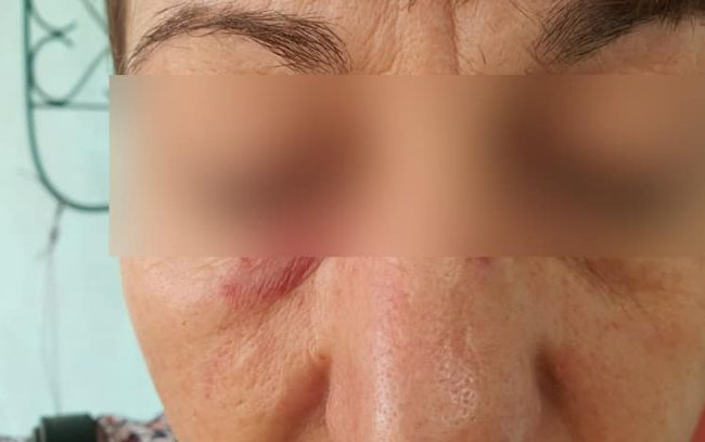 Трагедия в Сумах: пассажир изувечила кондуктора из-за маски